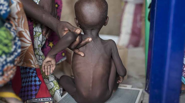 "420,000 Nigerian children could diÂ£ this year due to severe acute malnutrition" UNICEF warns